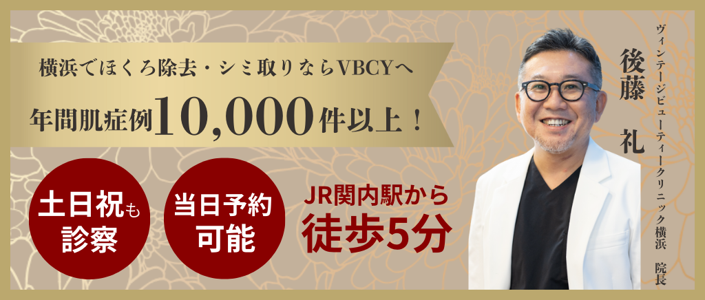横浜でほくろ除去・シミ取りならVBCYへ