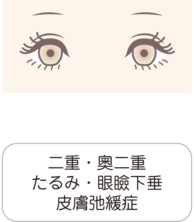 二重・奧二重・たるみ・眼瞼下垂・皮膚弛緩症