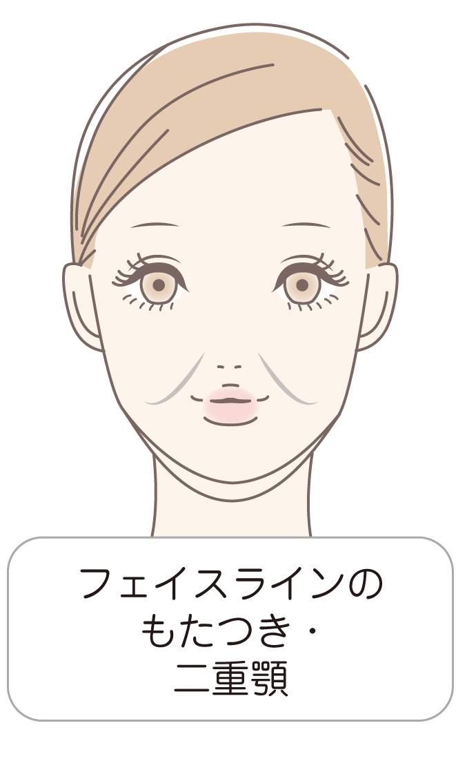 フェイスラインのもたつき・二重顎