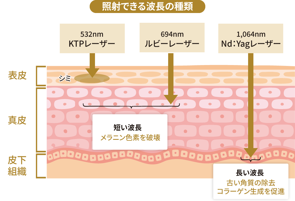 PICOレーザーで照射できる波長の種類と深達度（532nm・694nm・1,064nm／表皮・真皮・皮下組織）