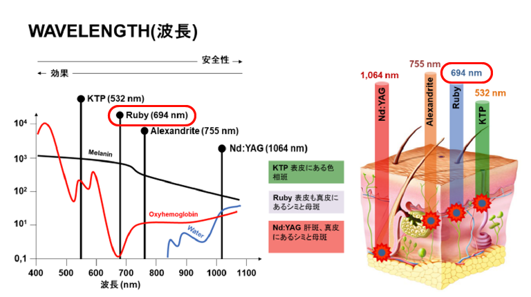 ルビーレーザー694nmの波長とメラニン色素への吸収の説明図